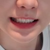 Noonayoon