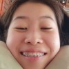 Mm