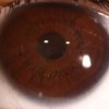 Eyes