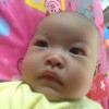 คู่แฝดโอเอ