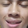 Dickrara