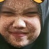 im lisz