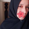 chromosome_xx