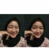 Lim Ssi