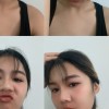 NINI