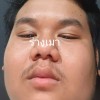 โก๊ะครับ