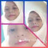 MBSana
