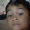  Derapis